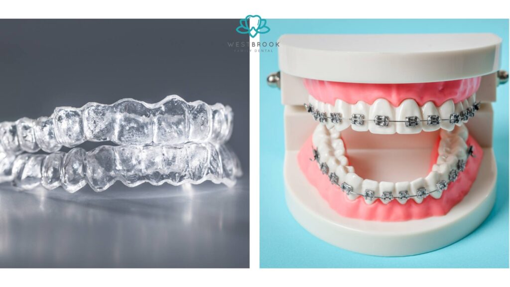 Teeth Braces Invisible vs. Traditional Braces: Which One is Right for You?
