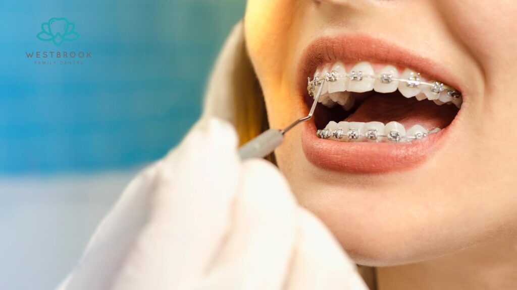 How Long Do Teeth Braces for Adults Take A Complete Timeline Westbrook Dental