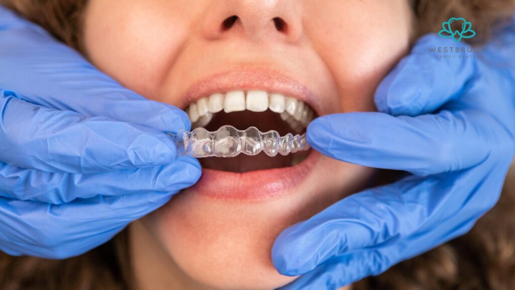 Invisalign Cost