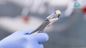 Wisdom Teeth Extraction