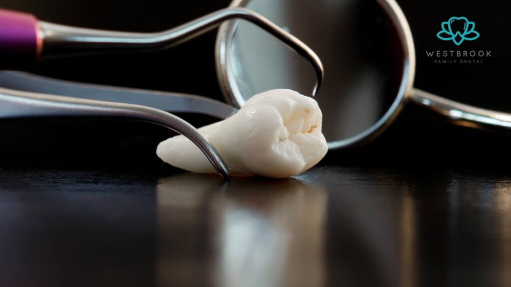 Wisdom Teeth Extraction Healing Time: How Long Does It Really Take? Wisdom Teeth Extraction