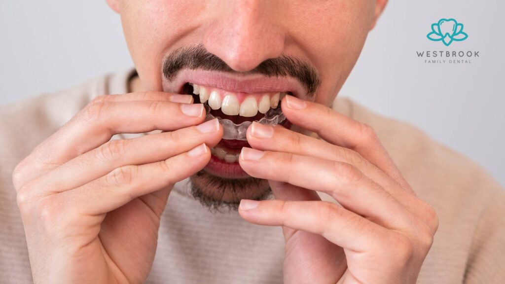 How Much Invisalign Costs vs Braces: Which Is the Better Investment? Westbrook Dental