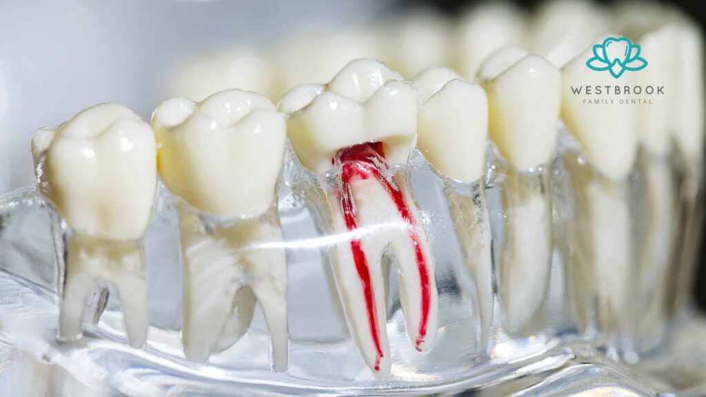 Laser Dentistry’s Rise: Faster, Comfortable Root Canals and Beyond in 2025 Root Canal