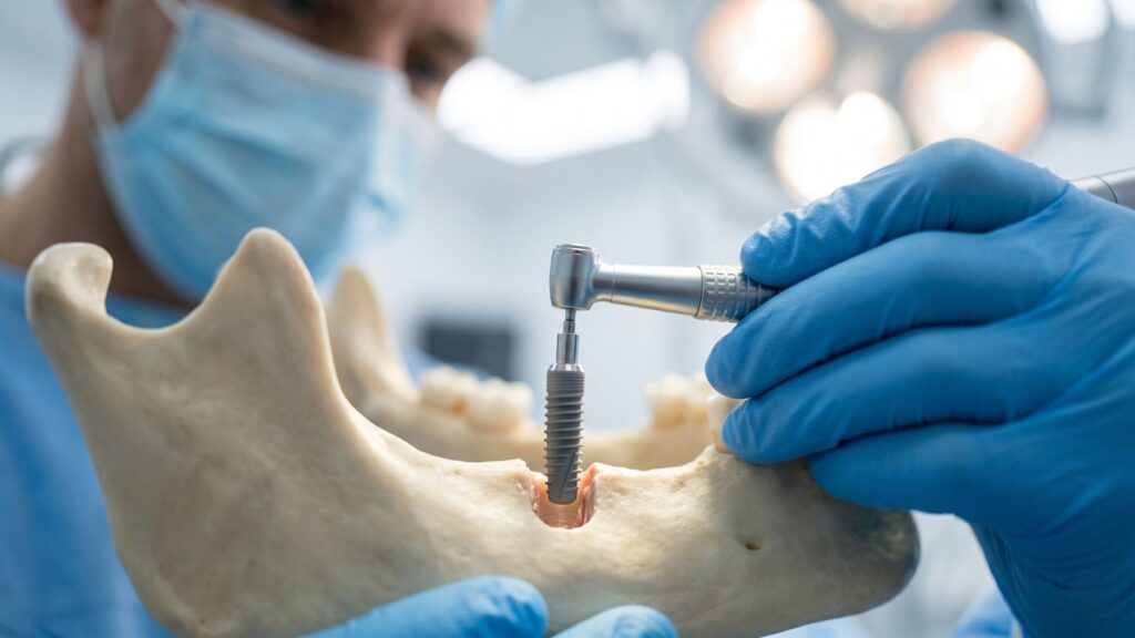 The Complete Blueprint: Mastering Your Dental Implant Procedure from Day One Westbrook Dental