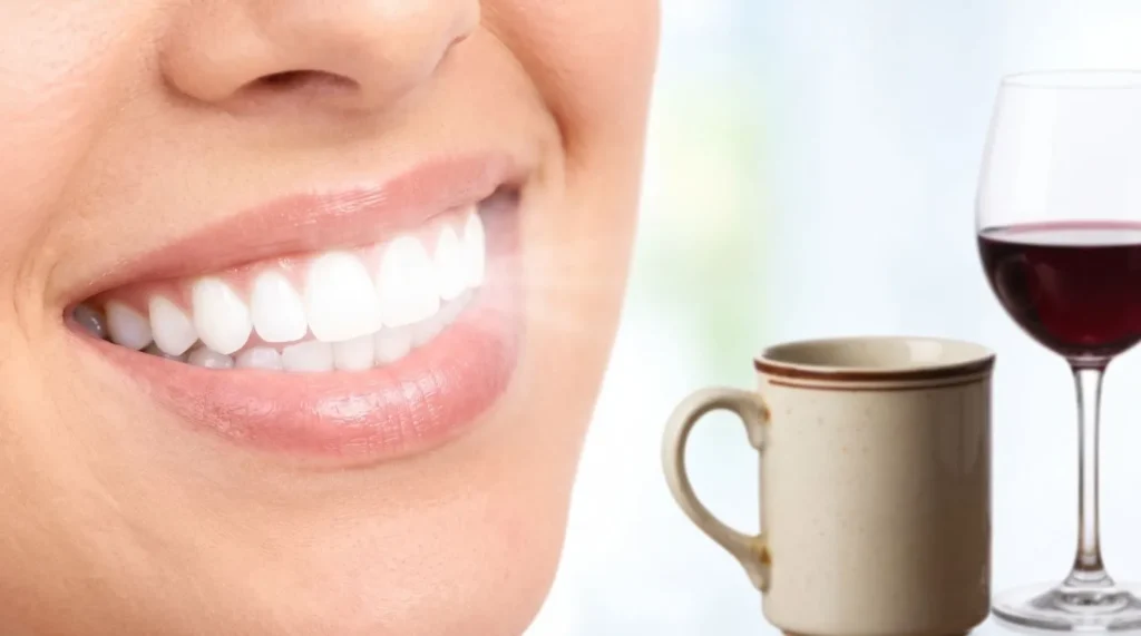 Professional Teeth Whitening Toowoomba: In-Chair vs Take-Home Kits Explained A bright, clean smile conveys vitality, health, and confidence. Over time, however, exposure to rich foods, morning coffees, and natural aging gradually darkens the natural shade of our teeth.
For patients searching for safe and effective teeth whitening Toowoomba services, the sheer volume of over-the-counter charcoal scrubs, whitening strips, and online LED gadgets can be overwhelming.
While supermarket whitening products often promise dramatic changes, only clinical-grade whitening overseen by an experienced teeth whitening dentist Toowoomba residents rely on can deliver noticeable, safe, and long-lasting results without eroding sensitive tooth enamel.
Why Do Teeth Discolour?
To understand how whitening works, it helps to understand the two main types of dental staining:
Extrinsic Stains: These surface stains develop in the outer enamel layer, primarily caused by chromogens (pigment compounds) found in coffee, tea, red wine, cola, curry sauces, and tobacco smoke.
Intrinsic Stains: These deeper discolourations sit within the inner dentin layer of the tooth. They can result from childhood exposure to certain antibiotics (such as tetracycline), excessive fluoride ingestion, natural enamel thinning from aging, or trauma to a tooth's internal pulp.
Over-the-counter abrasive pastes only scrub at surface debris, which can scratch enamel if used excessively. In contrast, professional teeth whitening Toowoomba dental clinics administer uses safe, buffered hydrogen or carbamide peroxide gels that penetrate micro-pores in the enamel to break down deep intrinsic pigment molecules.
In-Chair Whitening vs Custom Take-Home Kits
When visiting a reputable cosmetic dental clinic Toowoomba locals trust, you will generally be offered two proven pathways: immediate in-chair whitening or a dentist-prescribed custom take-home system.
The In-Chair Advantage: Philips Zoom!
For patients seeking immediate results—such as before a wedding, graduation, or milestone event—in-chair Zoom teeth whitening is the most efficient choice.
Your dentist applies a protective resin barrier over your gums and lips, exposing only the enamel. The high-potency whitening gel is applied and activated using a specialised blue LED light, breaking apart stubborn stains across three or four 15-minute cycles in a single appointment.
The Custom Take-Home System
If you prefer whitening at your own pace from home, your dentist takes precise digital impressions of your dental arches to fabricate custom-fitted plastic trays.
Unlike generic store-bought trays, these custom trays fit flush against your teeth, keeping the whitening gel in direct contact with enamel while preventing it from leaking onto delicate gum tissue. You simply apply the prescribed gel into the trays and wear them daily for 30 to 60 minutes over a fortnight.
Is Whitening Safe for Sensitive Teeth?
Temporary tooth sensitivity is the most common concern for whitening patients. It occurs when peroxide opens microscopic channels (dentinal tubules) leading toward the tooth nerve, making the tooth temporarily sensitive to hot and cold temperatures.
How Dental Clinicians Minimise Sensitivity:
Pre-Whitening Oral Health Check: We inspect your teeth for active cavities, leaking restorations, or exposed root surfaces through general dentistry examinations before applying bleaching agents. Bleaching gel applied over untreated decay can cause sharp nerve irritation.
Desensitising Formulations: Modern whitening gels like Philips Zoom incorporate ACP (Amorphous Calcium Phosphate) and potassium nitrate to soothe nerve endings and remineralise enamel during treatment.
Customised Peroxide Concentrations: Take-home gels come in various strengths (from 10% to 22%), allowing your dentist to calibrate the formula to your personal sensitivity threshold.
Maximising Your Whitening Results: The First 48 Hours
Your enamel remains slightly porous for the first 48 hours following any bleaching session. To lock in your bright new shade, follow the standard "White Diet":
What to Avoid:
Black tea, espresso, flat whites, and hot chocolate
Red wine, dark beers, and coloured spirits
Berries, tomato-based pasta sauces, soy sauce, and curries
Tobacco products and coloured mouthwashes
What to Enjoy:
Water, milk, and clear soda
Chicken breast, white fish, and tofu
White rice, plain pasta, and peeled potatoes
Cauliflower, white bread, and plain yoghurt
Whitening as Part of a Comprehensive Smile Makeover
Teeth whitening is often the first step in a broader smile makeover Toowoomba treatment plan.
Because restorative materials like composite resin, ceramic crowns, and dental veneers cannot be lightened with bleach, whitening your natural teeth first allows your dentist to match future restorations directly to your brightest, cleanest enamel shade.
Frequently Asked Questions
Will teeth whitening damage my tooth enamel?
No. Professional whitening products formulated for dental use are pH-balanced and thoroughly tested to ensure they do not strip or soften healthy tooth enamel when used according to clinical instructions.
How long do teeth whitening results last?
Results generally last between 12 and 24 months, depending on lifestyle factors such as your intake of coffee, tea, and red wine, as well as routine oral hygiene. Most patients maintain their shade with brief touch-up sessions once or twice a year using custom trays.
What should I do if my gums feel irritated after whitening?
Mild irritation typically subsides within 24 hours. Using a soft-bristled brush and an anti-sensitivity toothpaste containing potassium nitrate helps soothe tissues quickly. If pain persists, our emergency dentist team is available for advice.
About Westbrook Family Dental
Located within the growing Westbrook community, Westbrook Family Dental provides high-quality cosmetic, preventive, and restorative dental care to individuals and families across the Toowoomba region.
Our modern practice is designed to make your visits calm, comfortable, and efficient. We use proven clinical whitening systems that deliver consistent, predictable shade improvements while prioritizing the health and safety of your enamel and gums.
Address: 85 Main Street, Westbrook QLD 4350
Phone: (07) 4529 7477
Website: westbrookdental.com.au
Read More / Learn More:
Discover in-chair Zoom Teeth Whitening
Explore our full range of Cosmetic Dentistry
Learn about teeth alignment with Orthodontics
Long-term tooth restorations via Dental Implants
Preventive hygiene and checks at General Dentistry
Same-day care through our Emergency Dentist Services